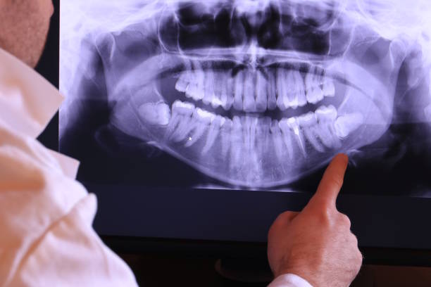 Best Emergency Tooth Extraction in Woonsocket, RI