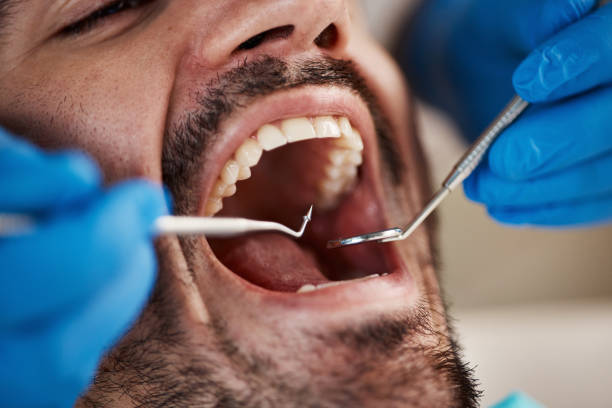 Best Emergency Broken Tooth Repair in Woonsocket, RI