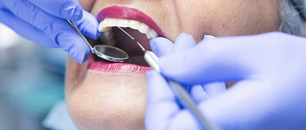 Best Emergency Tooth Extraction in Woonsocket, RI